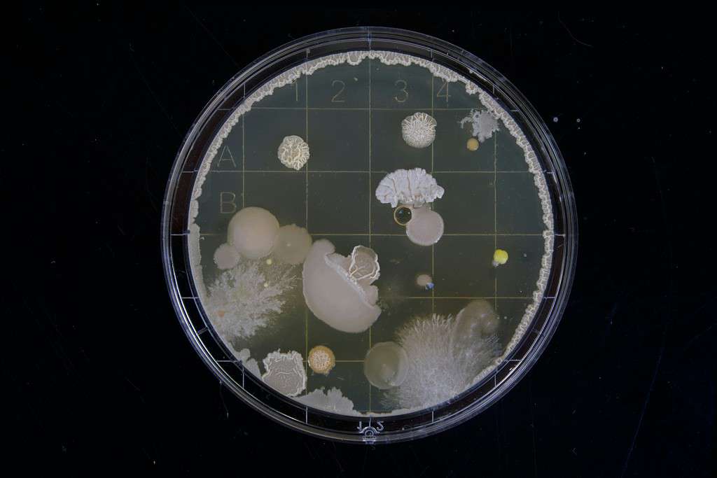 a petri dish with several cultures